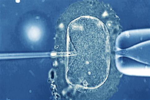Μικροσυσκευή επιτρέπει εξωσωματική γονιμοποίηση εντός της μήτρας